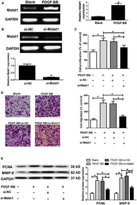 Upregulation of LncRNA Malat1 Induced Proliferation and Migration of Airway Smooth Muscle Cells via miR-150-eIF4E/Akt Signaling